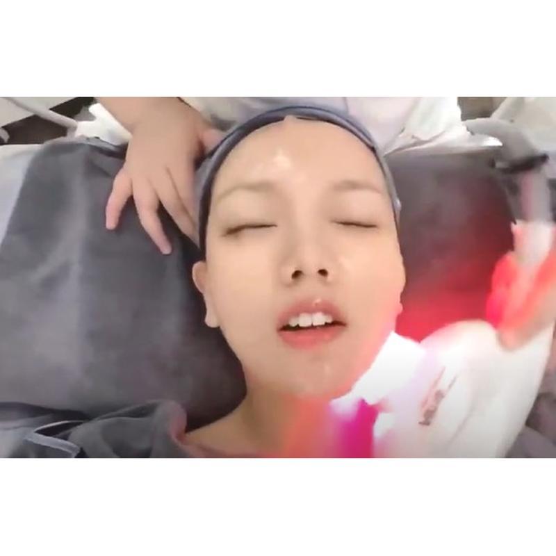 Máquina de Pulso para Rejuvenescimento da Pele com Luz de Leite NIR de 1300nm