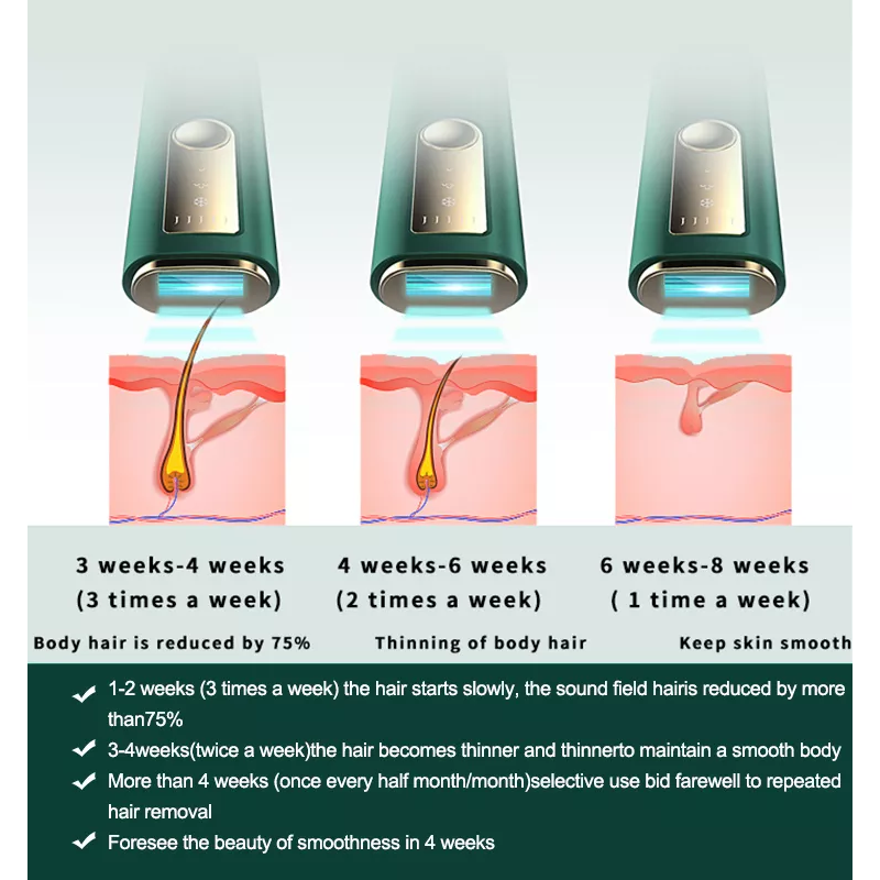 Envio direto para uso doméstico Aparelhos de remoção de pelos mini tubo de quartzo de 5ª marcha Dispositivo de remoção de pelos IPL permanente punho