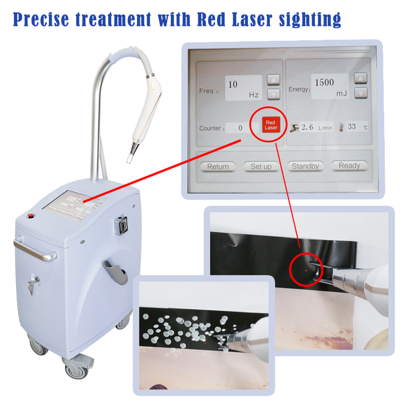 Máquina de Remoção de Tatuagem e Pigmento a Laser Q-Switch Nd Yag Pico Laser