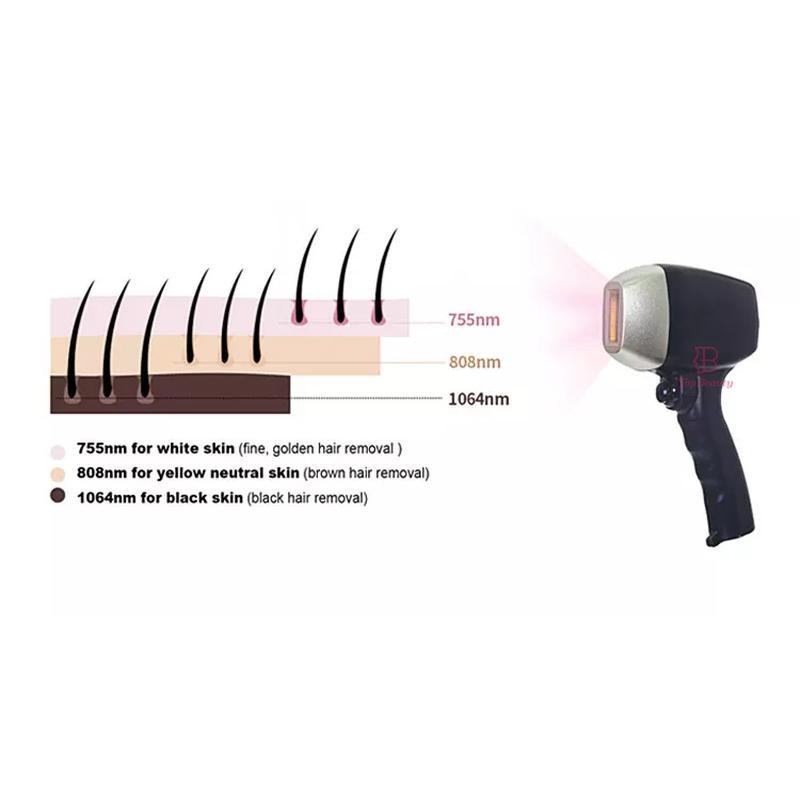 Máquina profissional de remoção de pelos a laser de diodo 808nm