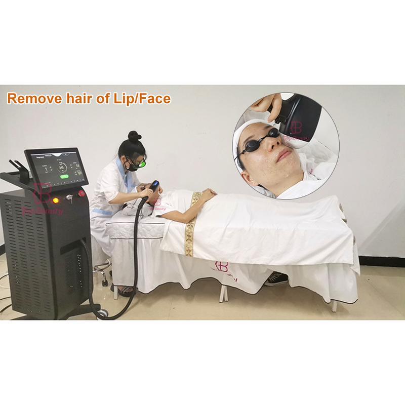 Máquina profissional de remoção de pelos a laser de diodo 808nm
