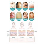 Máquina Profissional de Microneedling RF para Remoção de Cicatrizes e Rejuvenescimento da Pele