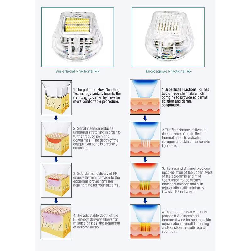 Máquina Profissional de Microneedling RF para Remoção de Cicatrizes e Rejuvenescimento da Pele