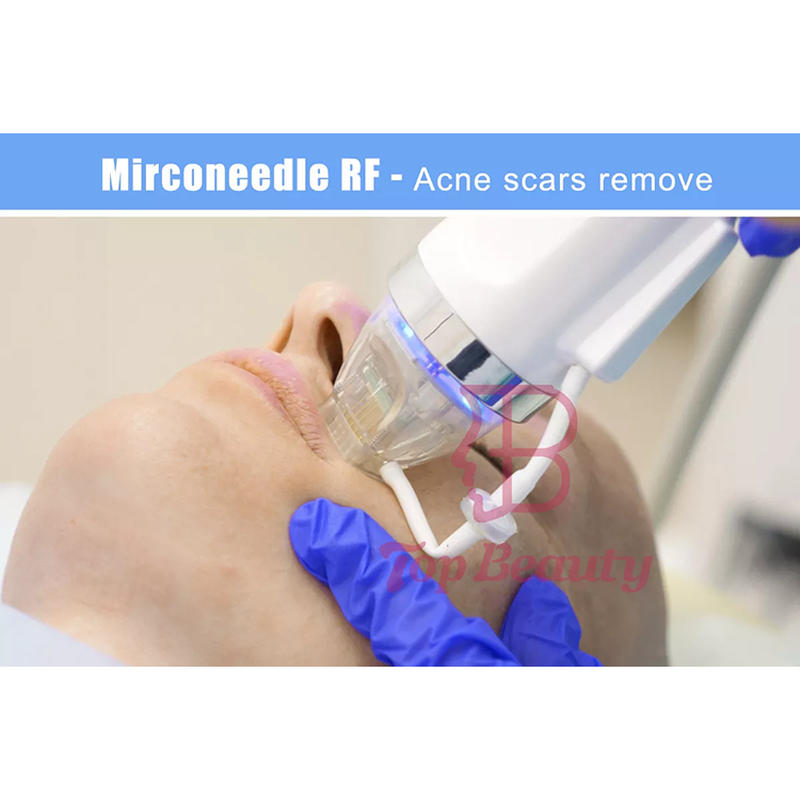 Máquina de microagulhamento fracionado RF com agulhas