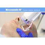 Máquina de microagulhamento fracionado RF com agulhas