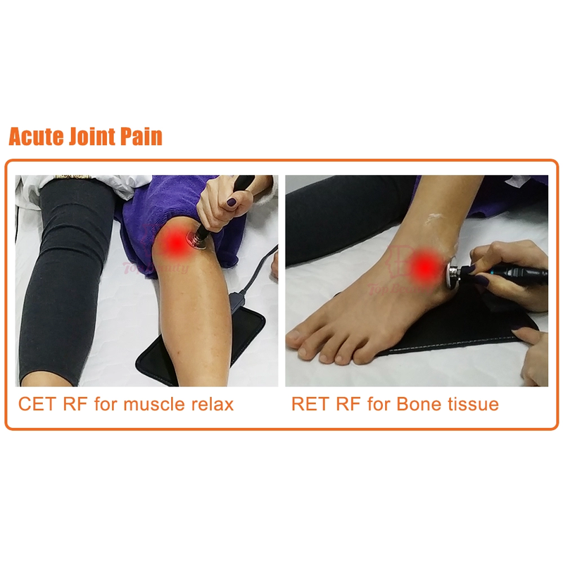 Terapia Tecar Physio Monopolar RF Resistiva e Capacitiva Máquina Tecarterapia Profissional