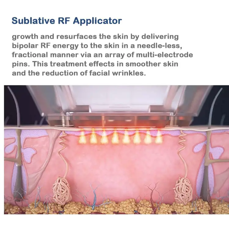 Sistema de RF Microagulhas + Thermagia Fractional RF para Microneedling de RF e Equipamento de Beleza com Frequência de Rádio Fracionada
