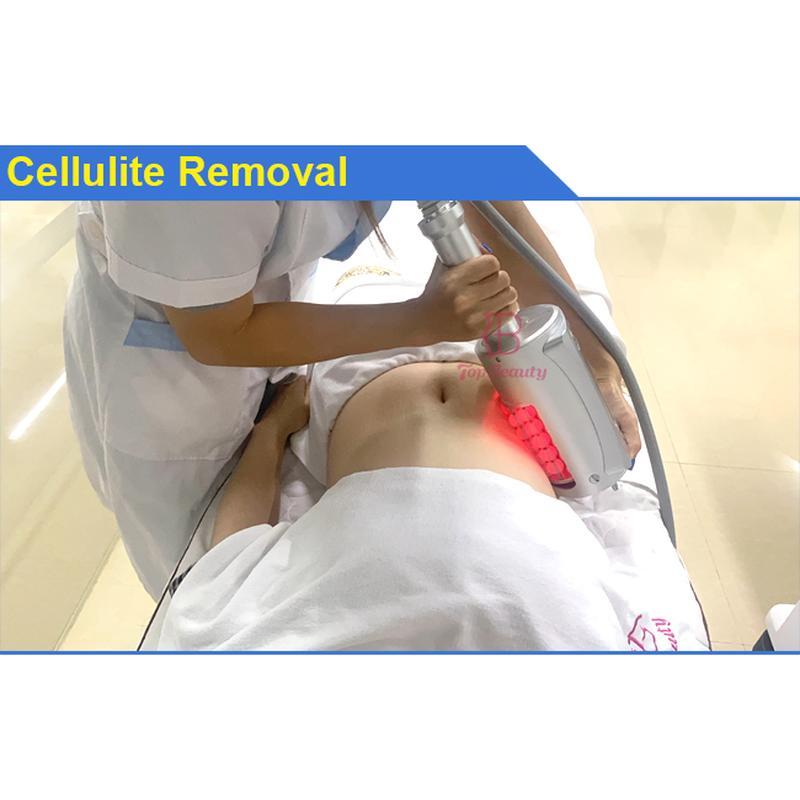 Máquina de celulite de massagem com rolo Endospheres