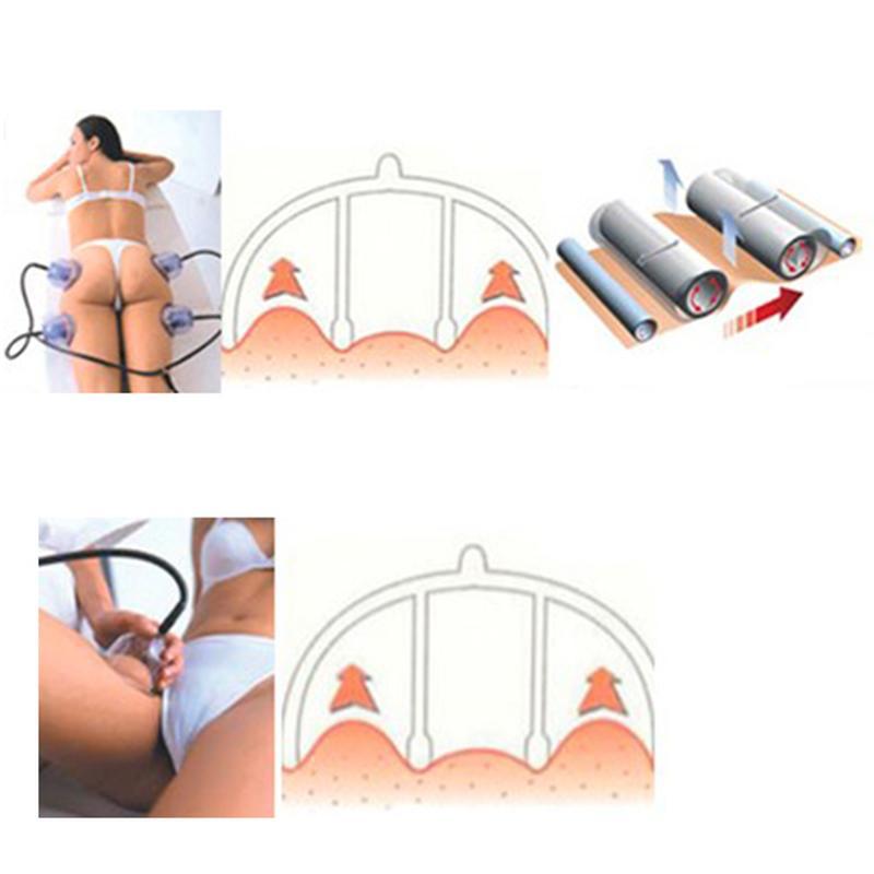 Terapia de vácuo Starvac Sp2 Massagem Terapia de Ventosa Massajador corporal emagrecendo máquina de copo a vácuo