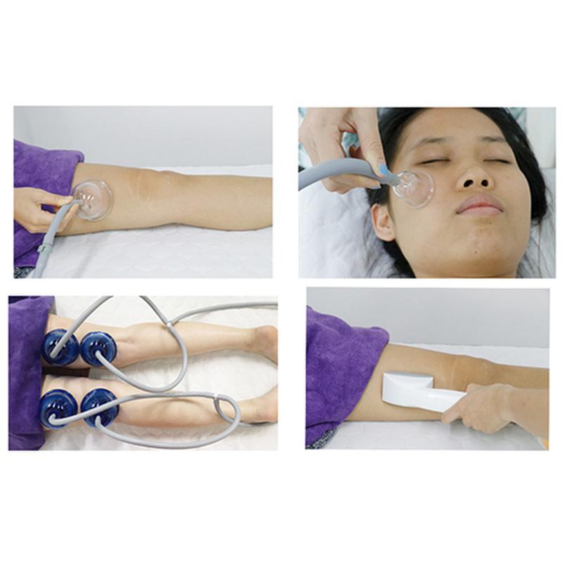 Máquina de terapia a vácuo com tela sensível ao toque starvac sp2 terapia de copo a vácuo emagrecimento